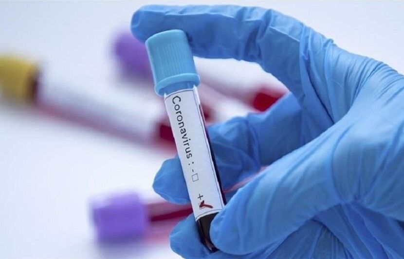 تسجيل 3 حالات جديدة للاصابة بفيروس كورونا والاشتباه بحالتين اخريين في ايران